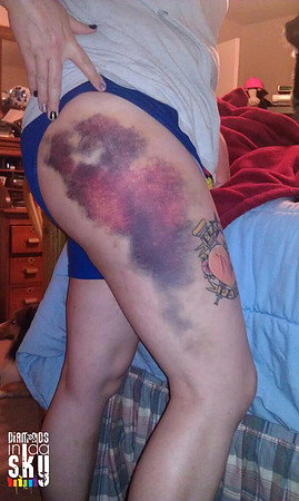 Princess Peaches N Pain, Assassination City Roller Derby