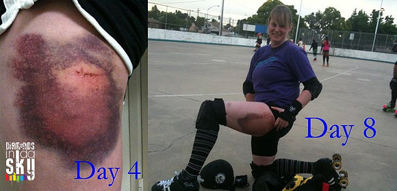 Professor Harmsworth , NOtown Roller Derby
